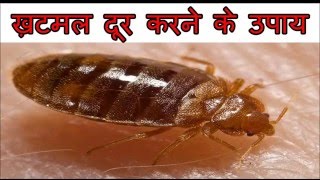 ख़टमल से छुटकारा पाने के घरेलू उपाय  How To Get Rid Of Bed Bugs [upl. by Netaf]