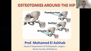 Osteotomies Around Hip  Prof Mohamed El Ashhab [upl. by Beata]