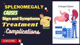 Splenomegaly Causes Sign And symptoms  Treatment complications Urdu  Hindi [upl. by Neved]