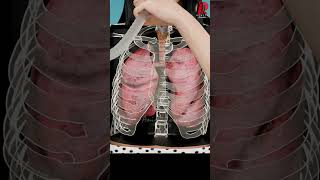 The Truth About Incentive Spirometry Doctor Explained [upl. by Hellene]