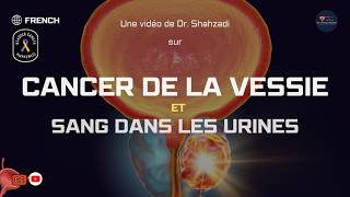 Cancer de la Vessie  Signes Précoces Symptômes et Sang dans les Urines Expliqués [upl. by Zrike607]