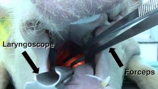 Endotracheal Intubation [upl. by Jacobsen]