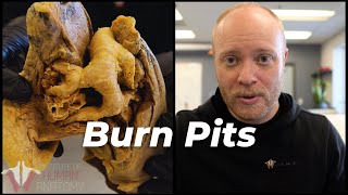 How Burn Pits Are Killing Military Veterans [upl. by Haroved]