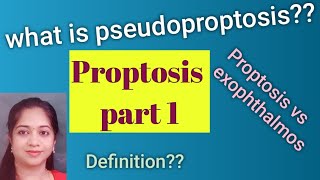 Proptosis Exophthalmos Pseudoproptosis Causes for psuedoproptosis MBBS Ophthalmology [upl. by Georgi348]