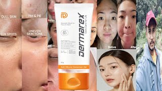 Dermarex Soft Silicone Sunscreen Gel SPF 50  Honest Review [upl. by Silisav]