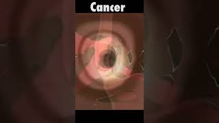 What cause esophageal cancer  esophageal esophagealcancer likeandsubscribe likesharesubscribe [upl. by Ennaul]