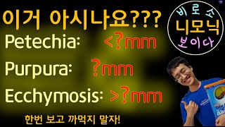 니모닉 Petechia purpura Ecchymosis [upl. by Friedrich]