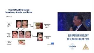 Unmet research needs in patient stratification  Atopic dermatitis [upl. by Feldstein333]