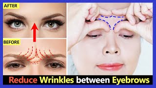 How to Get rid frown lines Reduce Wrinkles between eyebrows Naturally  Face Yoga amp Massage [upl. by Che87]