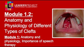 Module 12 Cleft Palate Speech and Feeding Anatomy and Physiology of Cleft Lip and Palate [upl. by Revolc170]