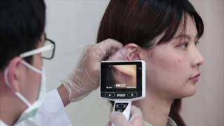 HD Digital Otoscope  Instructions for Usage  CEI Technology Inc [upl. by Carrnan]