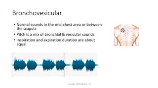 Bronchovesicular [upl. by Atinas]