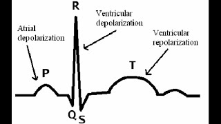 Kompleksi QRS në ECG tregon [upl. by Worrad]