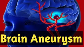 what is a brain aneurysm  brain aneurysm symptoms what causes brain aneurysm Treatment [upl. by Sterner778]