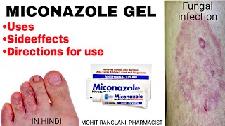 Miconazole nitrate cream  Uses sideeffects directions  Fungal infection treatment in Hindi [upl. by Ecydnarb]