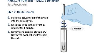 AmniSure® Training Video  ROM Diagnosis [upl. by Ellienad]