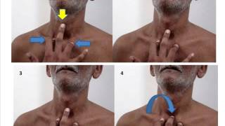 Palpation of trachea  outline of steps [upl. by Anot]