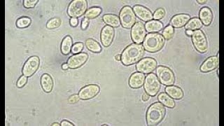 Activité B21 observation microscopique des levures de boulanger [upl. by Chancey]