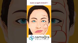 Understanding Hemifacial Spasm HemifacialSpasm DrKNeeraja Neurologist SamagraHospitals Guntur [upl. by Yeldarb711]