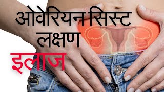 Ovarian cyst ke lakshan  Ovarian cyst kaise thik kare  ओवरी में गाँठ  Ovarian cyst kya hota hai [upl. by Ahsieit455]