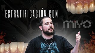 Estratificación de MiYo en directo [upl. by Aiehtela]