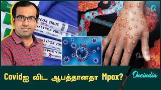 Mpoxல் இருந்து எப்படி தப்பிக்கலாம்  DrFarook Abdullah  Oneindia Tamil [upl. by Aimil]