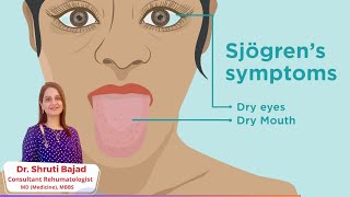 Sjogrens Syndrome  Dr Shruti Bajad  skincare arthritis [upl. by Airym]