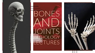 BONES AND JOINTS PATHOLOGY lecture 11 RHEUMATOID ARTHRITIS detailed and easiest explanation [upl. by Nylissej]