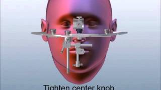 How to Transfer the Whip Mix Facebow from Patient to Articulator [upl. by Morrissey]