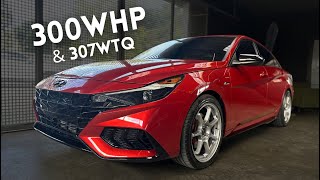 Elantra NLine 300WHP tuned by JV Performance Aramis Otero  DIPR Car Stories 74 [upl. by Nodroj]