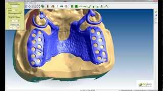 Logiciel CAO DIGISTELL pour la création de châssis squeletté pour prothésistes dentaires Part 2 [upl. by Nosiram]
