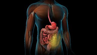 Opciones de tratamiento para la diabetes tipo 2 [upl. by Sinnal]