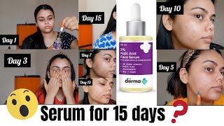 The Derma Co 2 Kojic Acid Face Serum  Treats Hyper Pigmentation  Dark Spots amp Blemishes JAHNABI [upl. by Sapienza]