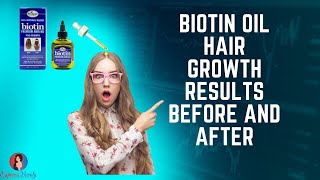 ✅😍Biotin oil for hair growth  Before vs After  Is Biotin Good for Hair Growth💇‍♂️ [upl. by Gilliam]