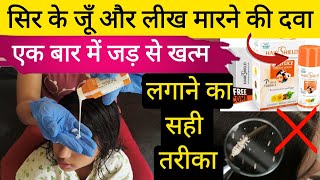 Sir ki Ju Kaise Khatam Kareजूं लीख मारने की दवा How to Apply Anti Lice Cream WashJu Marne ki Dawa [upl. by Chelton919]