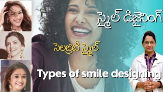 స్మైల్ డిజైనింగ్  రకాలు  Types of Smile designing [upl. by Dragone]