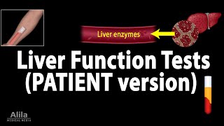 Liver Function Tests Animation for Patients [upl. by Liss866]