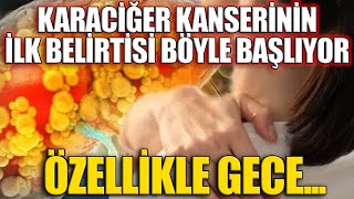 Karaciğer Kanserinin İlk Belirtisi Böyle Başlıyor Özellikle Gece [upl. by Nolak]