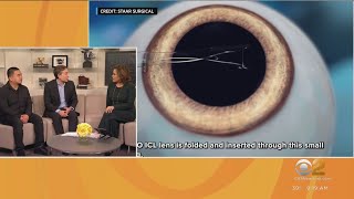 Doctor explains new eye procedure for vision problems [upl. by Anitsud]