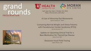 Abnormal Eye Movements Pseudotumor Cerebri Syndrome Thyroid Eye Disease Visual Field Testing [upl. by Matland10]