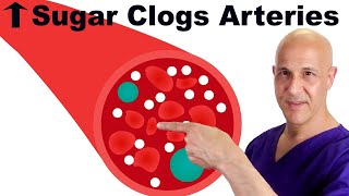 Prevent High Blood Sugar from Causing Clogged Arteries  Dr Mandell [upl. by Margarette]