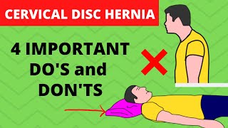 Cervical Herniated Disc Exercises to avoid Sleeping position Precautions [upl. by Haibot]