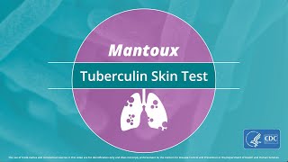 Mantoux Tuberculin Skin Test Video [upl. by Adnilema]