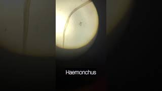 Haemonchus spp [upl. by Bashuk]