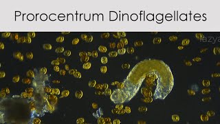 Prorocentrum Dinoflagellates [upl. by Ahsemed]