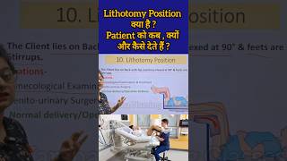 Lithotomy Position क्या है  Patient को कब क्यों और कैसे देते हैं reels medicalstudent shorts [upl. by Knowlton]