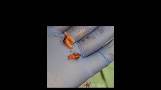 Root stumps Extraction dental dentalcare dentist satisfying dentalclinic [upl. by Yeleak448]