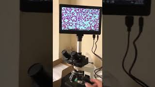 Trinocular Microscope with LED Screen [upl. by Yevreh]