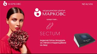 Радиочестотна терапия на лице в МЦ МАРКОВС с мултифункционален апарат Septum от Neauvia [upl. by Ahsykal]