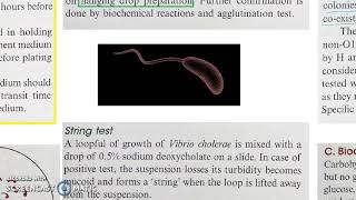 Microbiology 228 a Vibrio cholerae Cholera Lab Diagnosis [upl. by Lindley995]